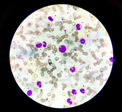 Neutrophils is a kinds of WBC or white blood cells analysis with light microscope.