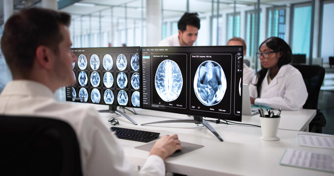 Doctors Carefully Studying MRI Scans