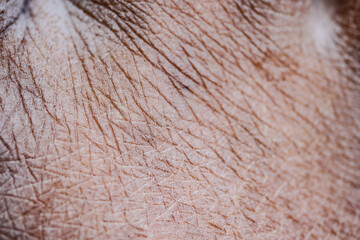 Close-up view of detailed dry skin texture
