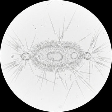  Trichocyst Discharge Detailed microscopic visualization of defensive trichocyst discharge in paramecium, educational and accurate.png