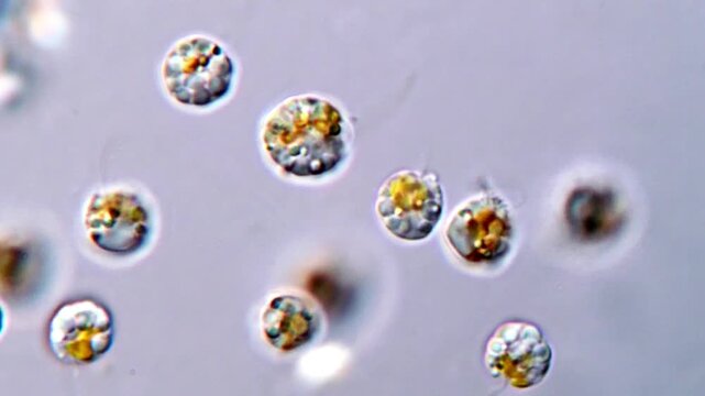 Toxic algae in pond water under microscope 