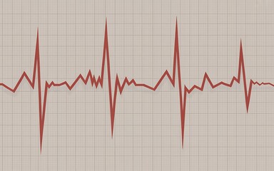 Heart beat on grid paper
