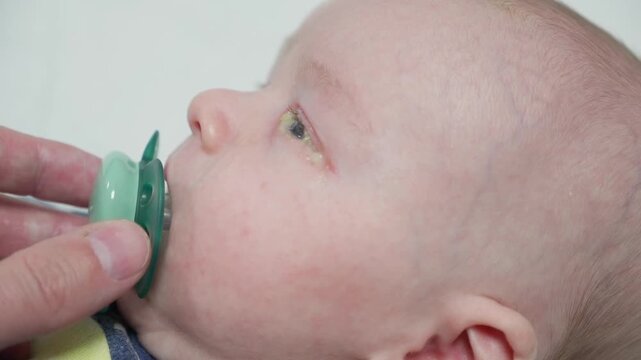 Baby eyes with eye mucus in selective focus. Disease tear ducts tons of newborns close up. Nasolacrimal duct obstruction in baby it is a blockage of the lacrimal drainage system. 