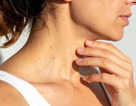 Woman's Neck and Chest with Moles, Hand Touching Skin, White Background