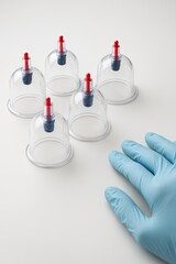 Five transparent cupping therapy cups. A blue protective medical glove rests nearby. Hijama, treatment according to the Sunnah.