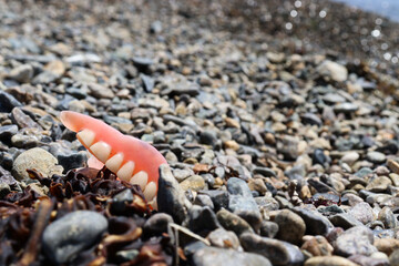 Artificial jaw prosthesis lost on the seashore. Dentistry and prosthetics.