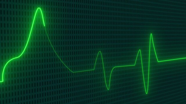 Heart rate monitor electrocardiogram background. Heart rate and pulse on black screen.Heartbeat monitor EKG line showing.