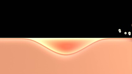 3D Animation of Acne cream drop and heal acne inflammatory to normal skin | Alpha Channel