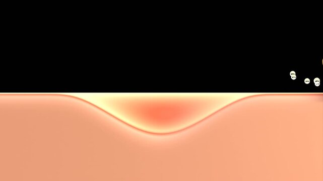 3D Animation of Acne cream drop and heal acne inflammatory to normal skin | Alpha Channel