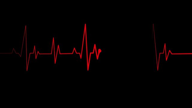 Minimalist Medical Monitor Screen Animation Showing Heartbeat Signal