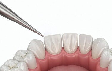  Oral hygiene: Air flow teeth cleaning process. Dental 3D illustration 