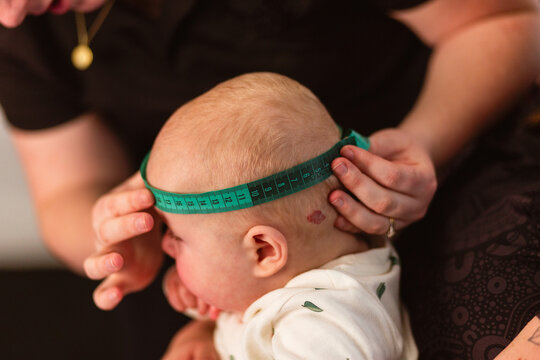 Physio performing Cranial Measurement assessment on baby