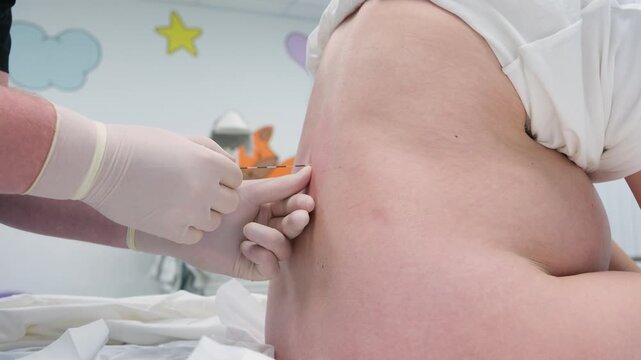 Skilled anesthesiologist administering epidural pain relief to expectant mother during childbirth, carefully managing labor discomfort within sterile hospital environment