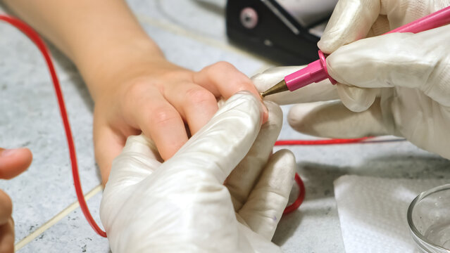 A homeopathic doctor does electropuncture diagnostics using a medical device and the Foll method by pressing on hand's points of patient to determine bioenergetics. Biotest. Homeopathic medicine