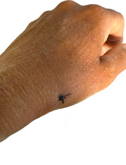 Wound seam body thread medicine