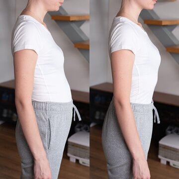 Before and after comparison showing bloated belly and flat stomach in a woman. Concept of digestion, diet, wellness, gut health, healthy habits, and lifestyle improvement.