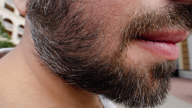 close-up of a bearded man's lower face