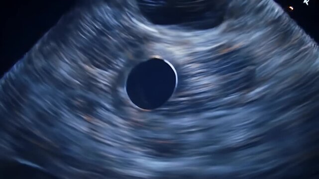Ultrasound Scan Fetal Image.