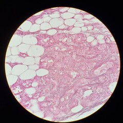 Microscopic view of elastic cartilage tissue from the epiglottis, showing connective fibers and adipose cells stained in pink.
