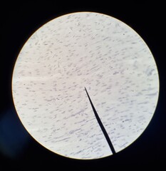 Microscopic image of human cardiac muscle tissue, displaying striated fibers and nuclei, with pointer indicating cell structure.
