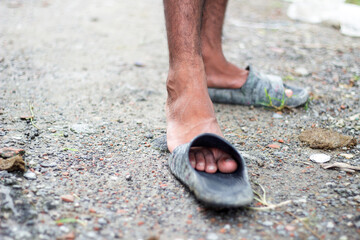Close up of a persons feet wearing wornout grey slides on a gravel path