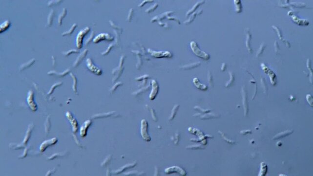 Microalgae under microscope, Green algae cells 