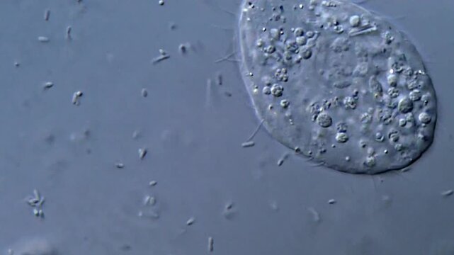 Bacteria and ciliophora under microscopy view 