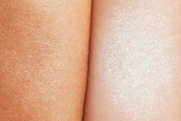 Comparison of child's skin texture before and after treatment