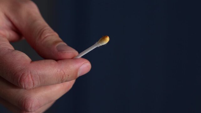 A dirty cotton swab after ear cleaning.
Ear wax on a cotton swab for ear cleaning (macro video).
Brown dirt on an ear swab after ear hygiene.
Cotton swab, cleaning, ears, dirty