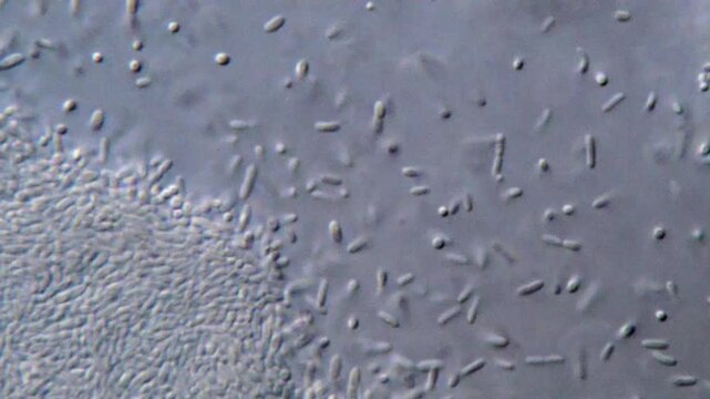 High resolution microscopy of bacteria colonies