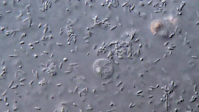 Bacteria and protozoa parasite in feces under microscope 