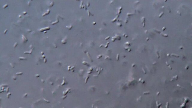 Bacteria under microscope showing cell structure