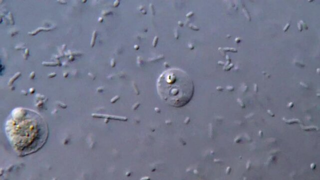 Protozoa microorganism and bacteria under microscope, feces sample 