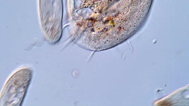 Ciliates Protozoa activity recorded with microscopy