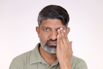 Close shot of man eye vision problem. Indian middle aged man suffering from red eyes. Sick eye problem man with conjunctivitis and allergies