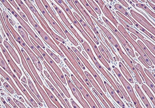 Cross section of cardiac muscle tissue under microscope