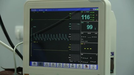 A close-up shot of a modern medical patient monitor displaying vital signs, including heart rate, blood oxygen saturation, and respiration rate. The screen shows electrocardiogram waveforms - Powered by Adobe