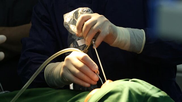 A close-up view of a surgeon's gloved hands performing a nasal endoscopy. Medical instruments are used to examine the nasal passages during the minimally invasive procedure.