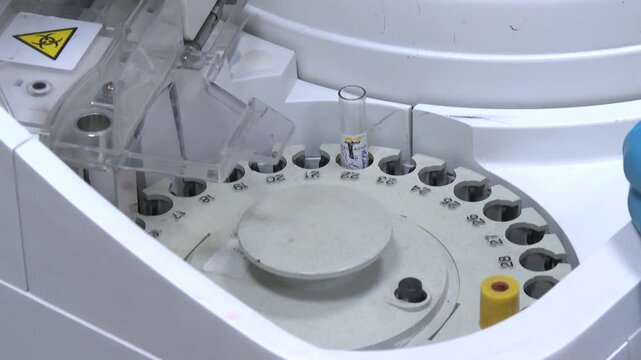 Close-up of a white laboratory centrifuge with blue knobs and a digital display showing time and speed settings. The lid is open, revealing sample tubes.