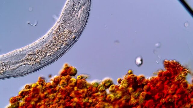 Stenostomum flatworm with algae and protozoa under microscope