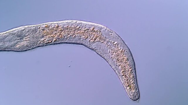 Detailed microscopy of Stenostomum flatworm with microorganisms