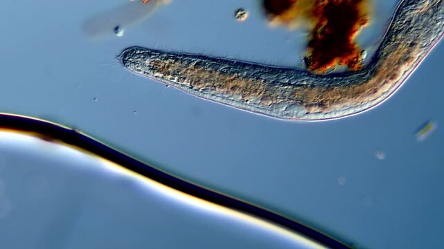Freshwater flatworm Stenostomum swimming near protozoa under microscope