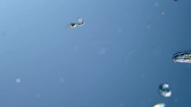 Close-up microscopy of Stenostomum flatworm in freshwater sample