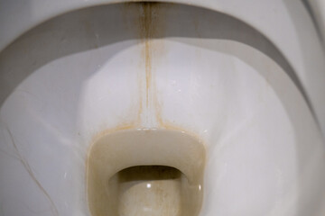 Unwashed home toilet. Dirty toilet bowl close-up.