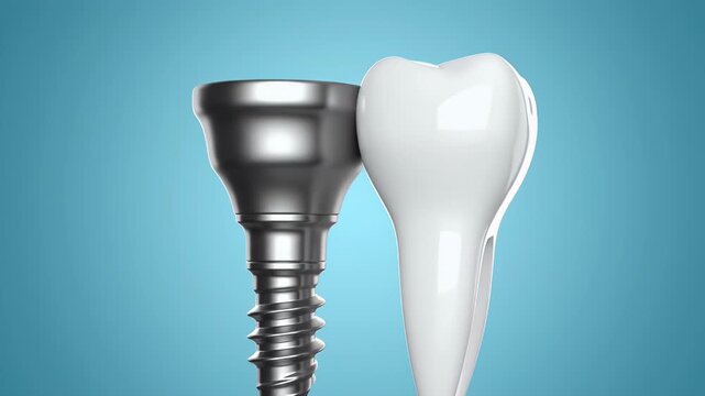 Dental Implant and Tooth on Blue Background