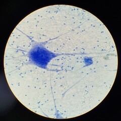 Microscopic image of human nerve cells showing neuron bodies and dendrites stained blue for structural visibility in a lab slide.
