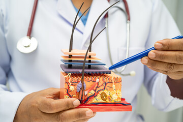 Hair transplant, Asian dermatologist doctor holding skin structure anatomy model for treatment in hospital.
