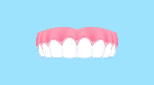 Upper teeth (Essix retainer) illustration vector design. Dental care concept.