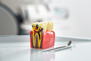 Colorful tooth model with dental tools emphasizes oral health education and consultation. Stomatology
