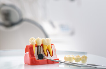 Stomatology concept. Detailed tooth model showcases the layers of enamel and dentin in a bright dental office equipped for patient care